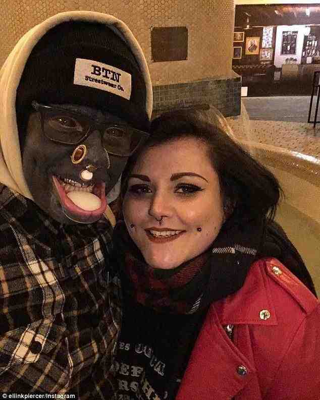 Bədəninin hər yerini döydürdü -  başqa bir adam oldu - FOTOLAR